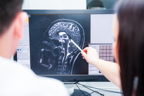 Head And Brain Injury Symptoms