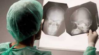 What to Know When Looking for a Brain Injury Lawyer